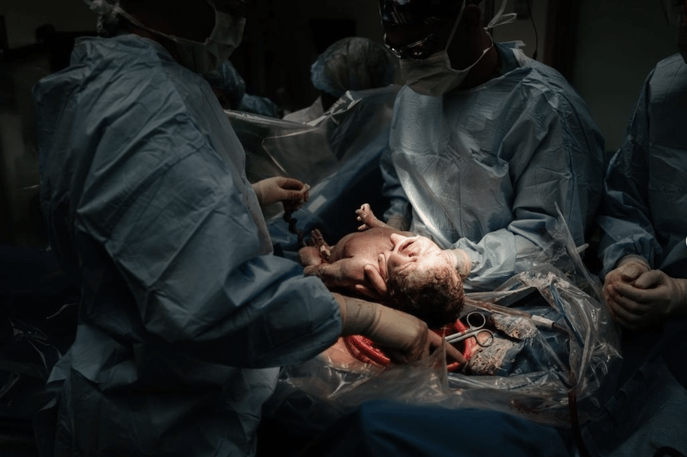 cesearan birth photography by Danielle Wilstead of Wild Oak Photography in Salt Lake City.